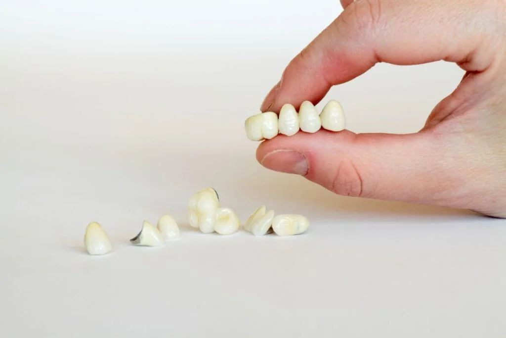 Dental Bridge Diamond Creek