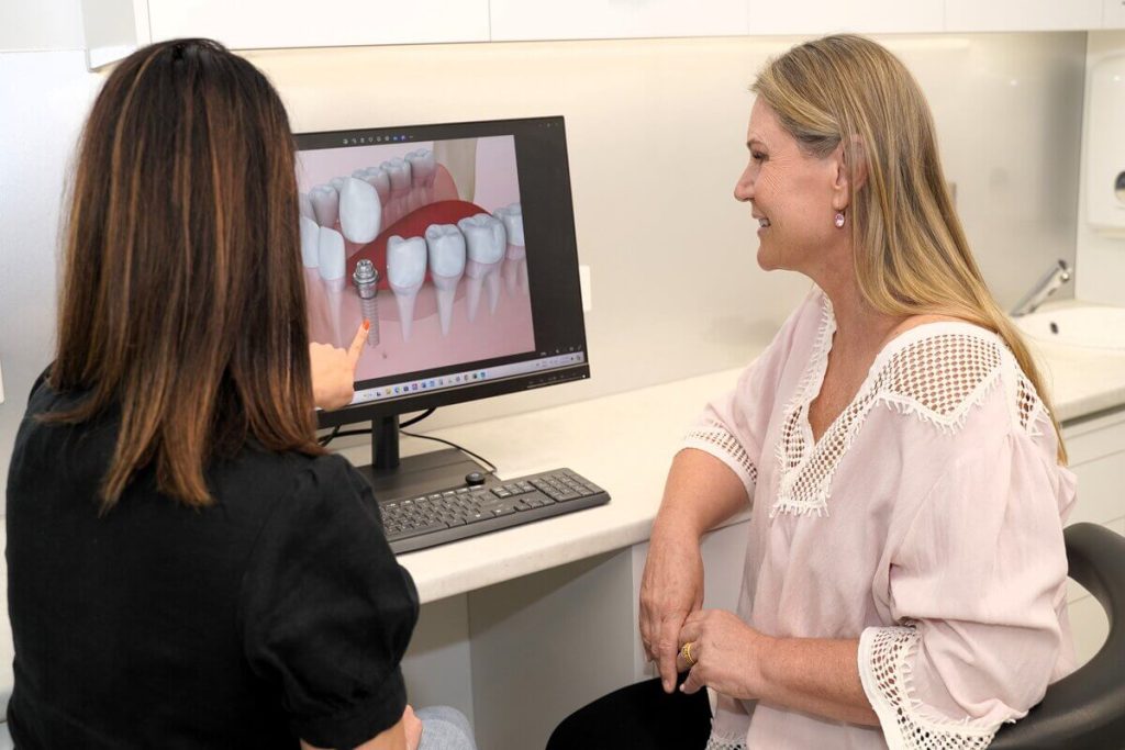 Diamond Creek Full Mouth Dental Implants