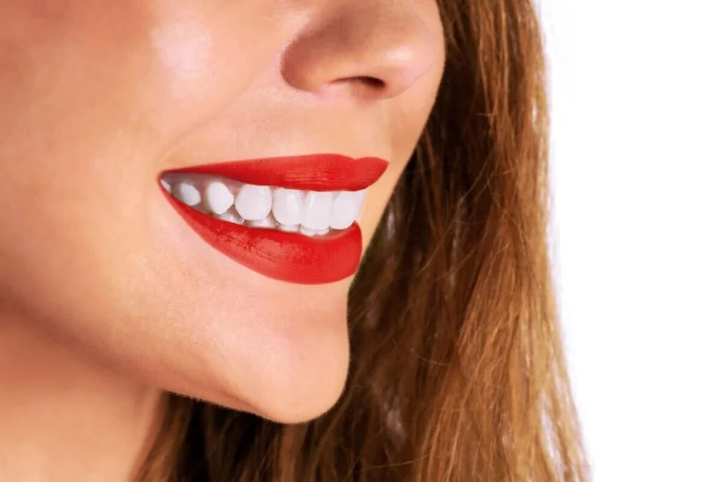 Teeth Whitening Diamond Creek